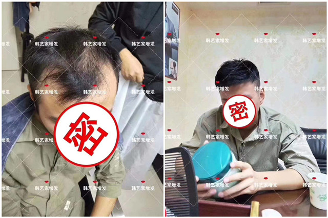 真人发隐形增发什么品牌好