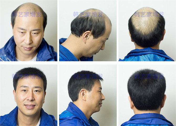 真人发隐形增发什么品牌好
