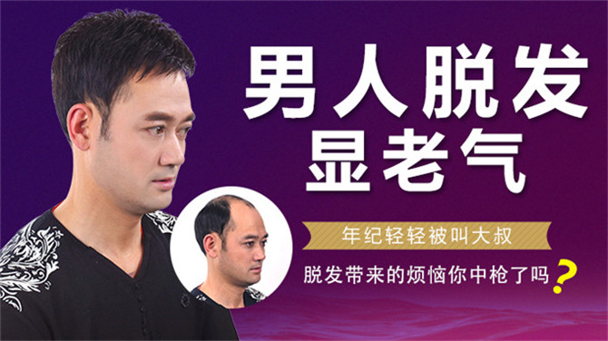 真人发隐形增发什么品牌好