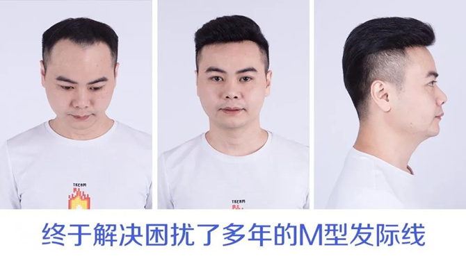 韩艺家增发