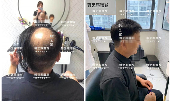仿真隐形中年假发