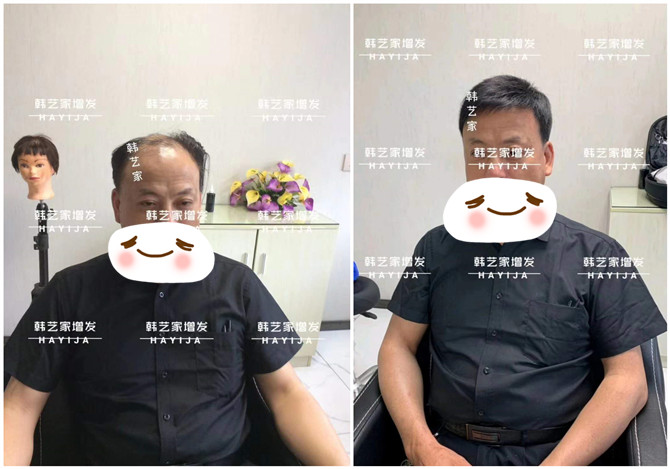 仿真隐形中年假发