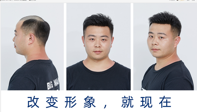 做隐形增发多少钱