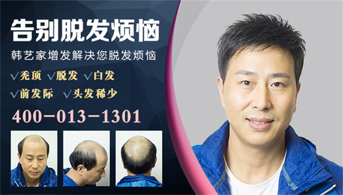 做隐形增发多少钱