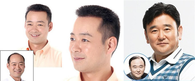 局部粘贴假发