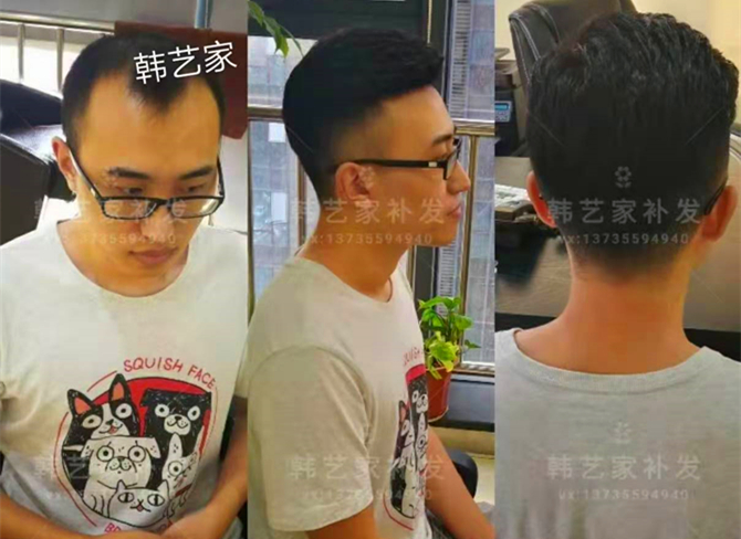 韩艺家无痕增发