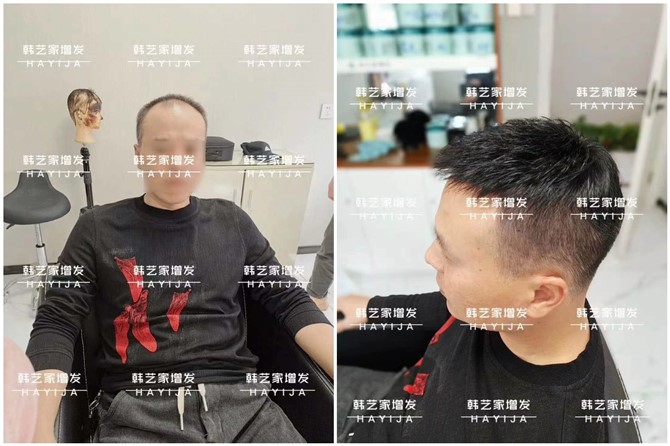 韩艺家无痕增发