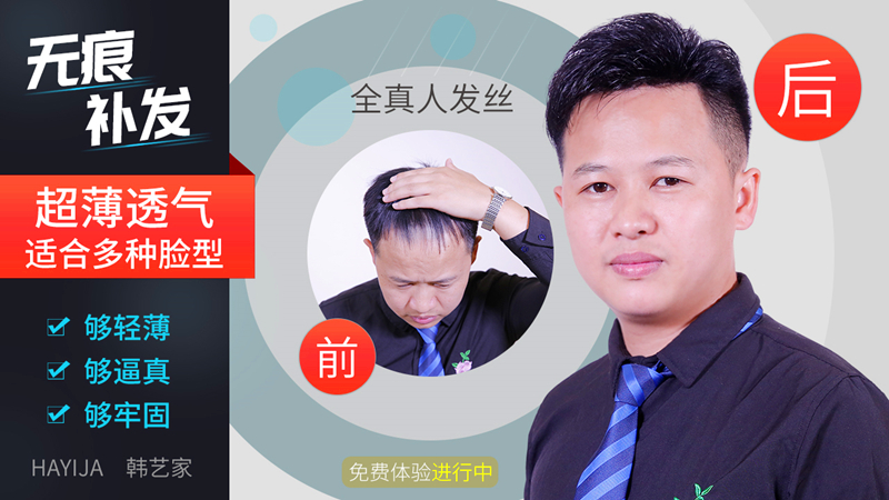 隐形织发补发效果