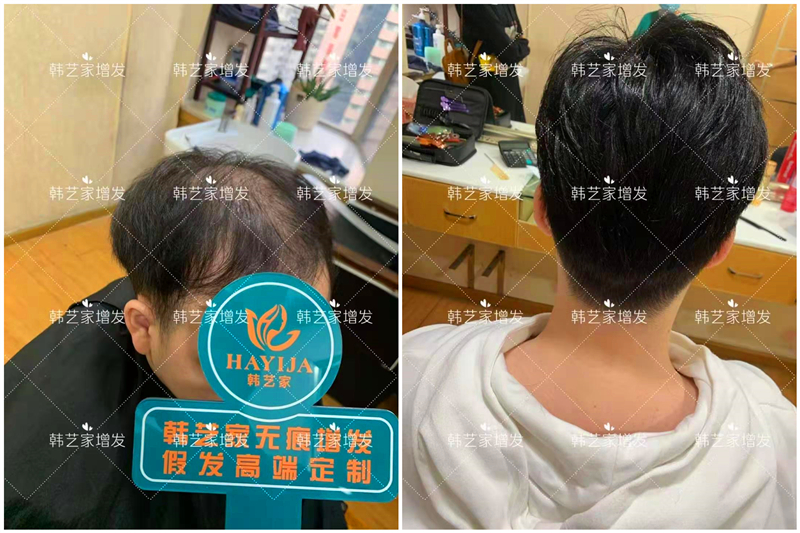隐形密发增发