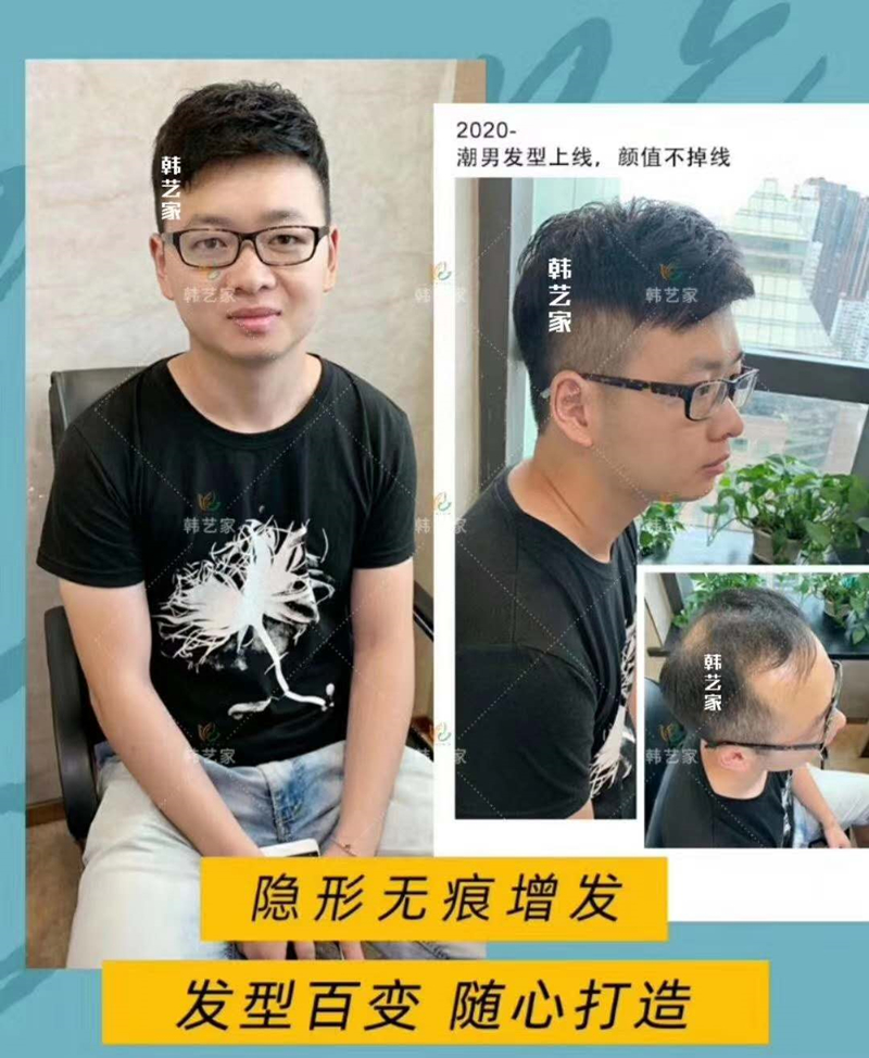 隐形密发增发