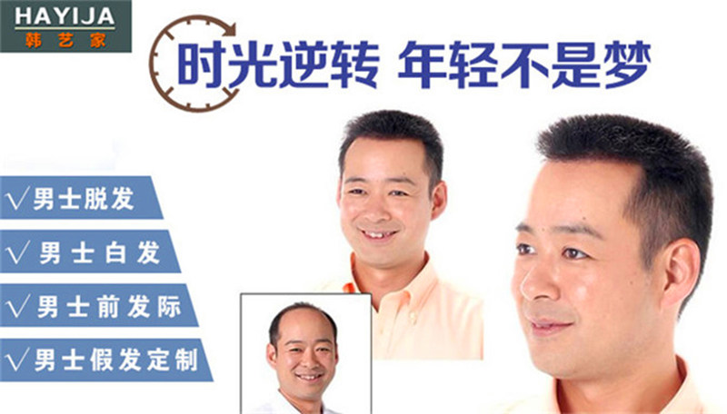 隐形补发