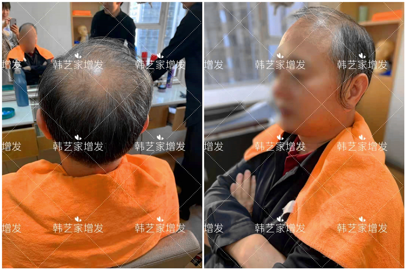 隐形补发