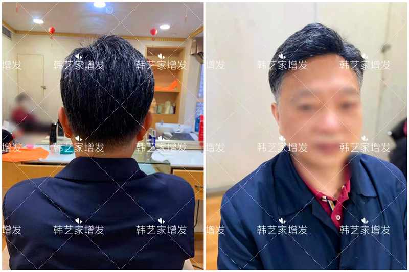 隐形补发