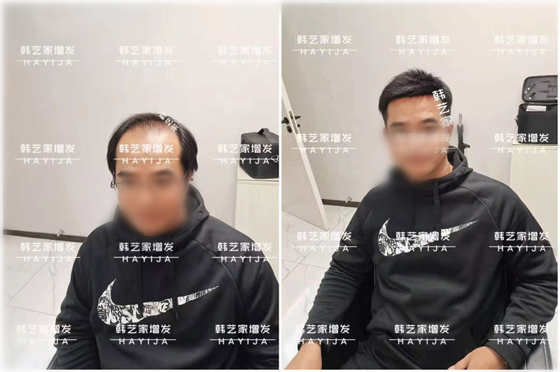 隐形增发