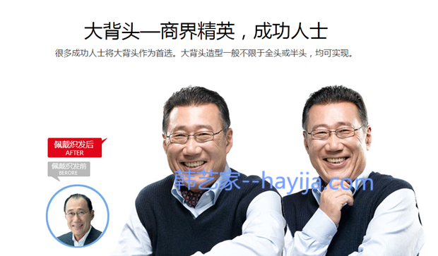 男人应该做隐形织发