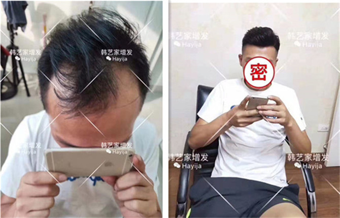 韩艺家增发
