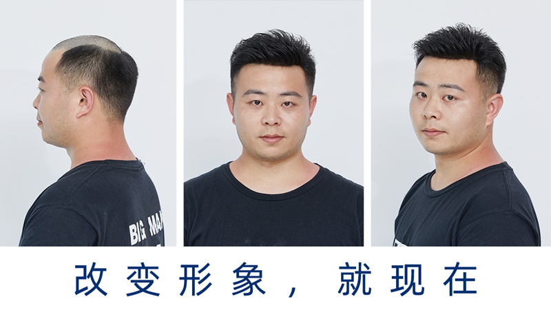 男士假发价格差别