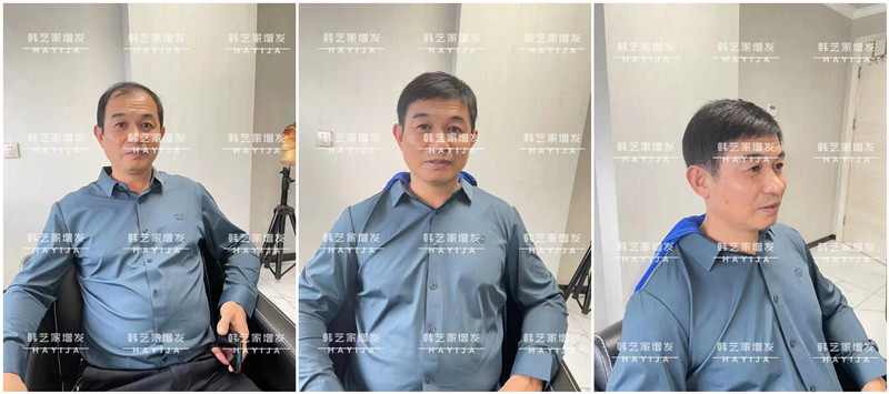 男士假发价格差别