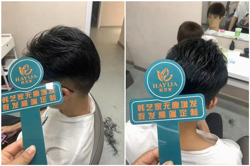 韩艺家隐形补发效果