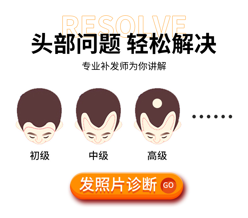 做隐形补发
