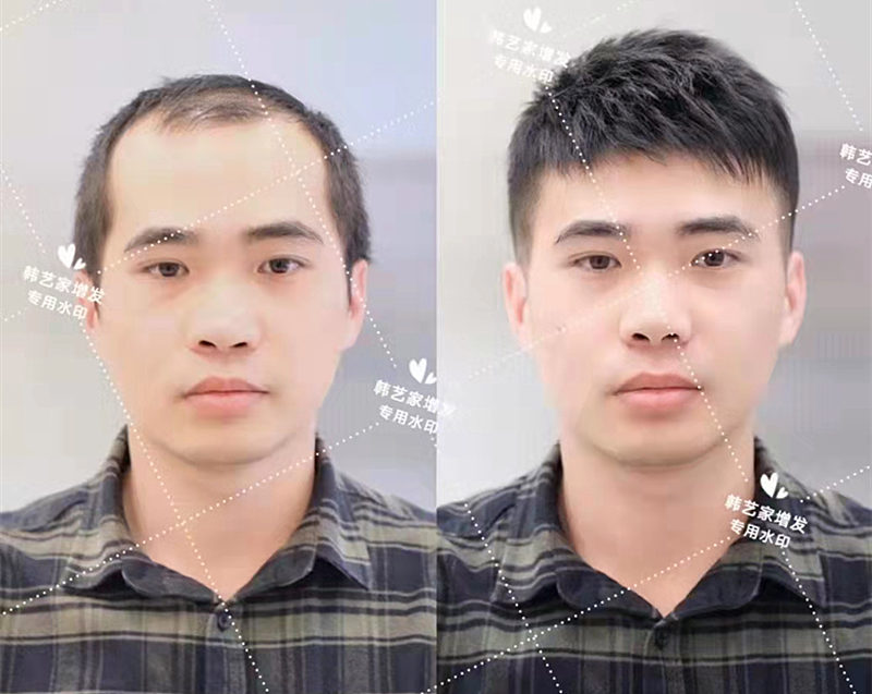 隐形补发