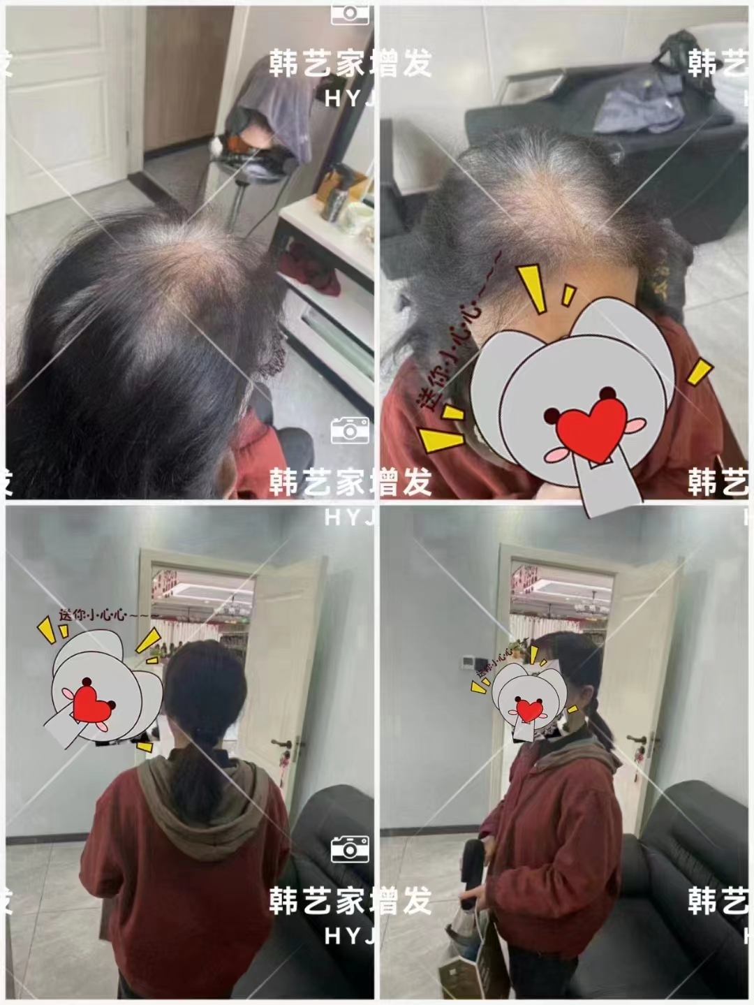 头发稀少咋办?