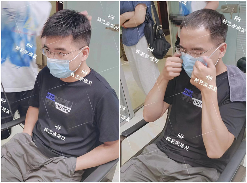 做隐形补发