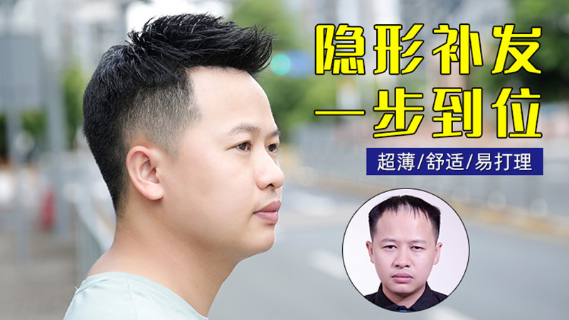 做隐形补发