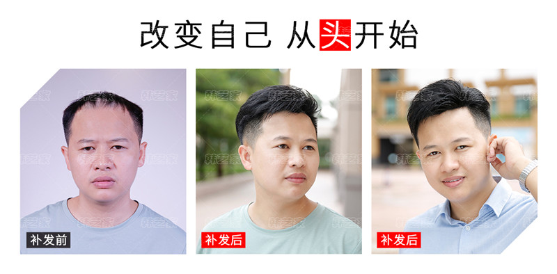 男士戴假发片舒服吗