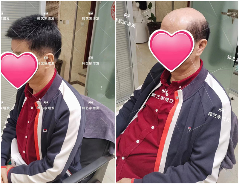 男士戴假发片舒服吗