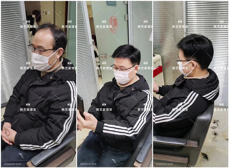 男士假发应该怎么选