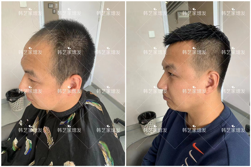 化纤假发太假不敢戴出门