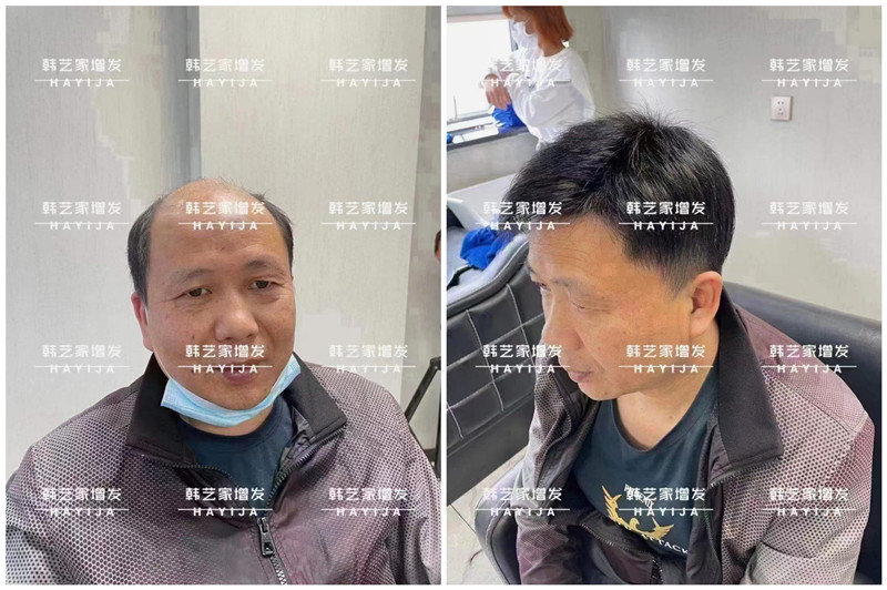 仿真头皮假发怎么样