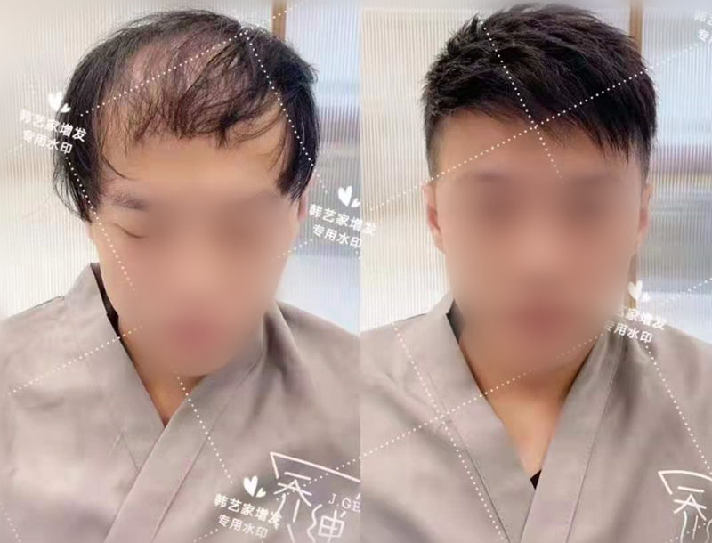 不露痕迹的假发