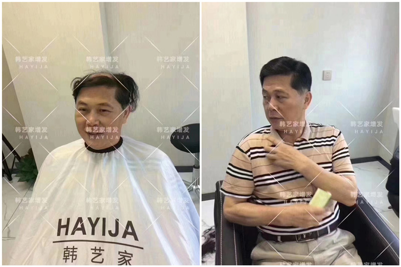 无痕假发补发