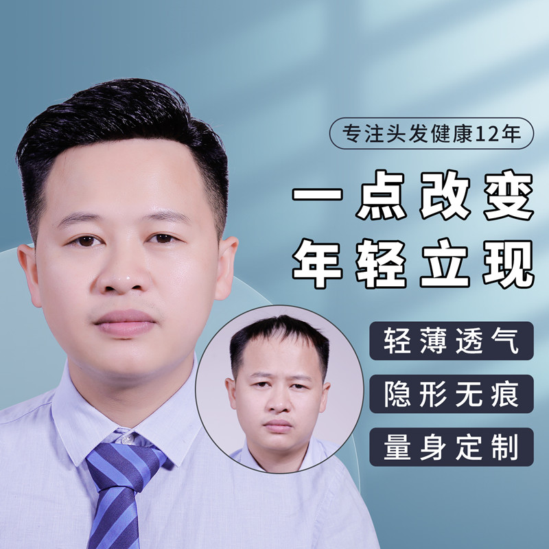 无痕假发补发