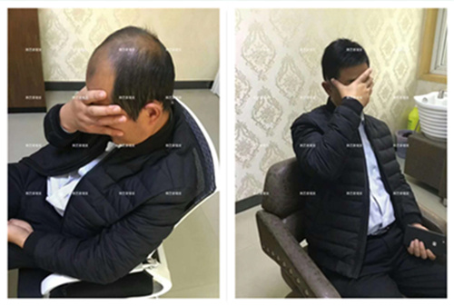 哪里补发好 哪里补发好,展示的补发效果图是骗人的吗?
