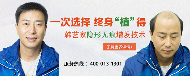 哪里补发好 韩艺家织发补发